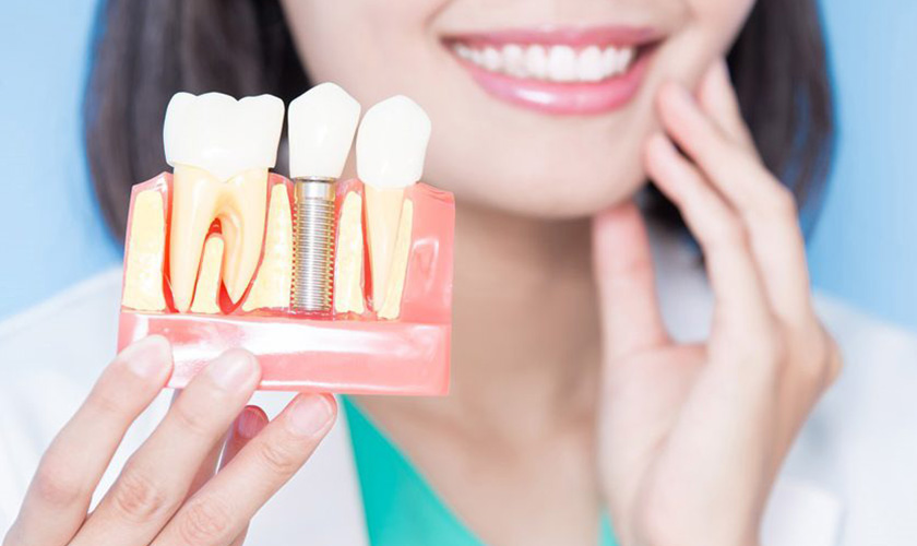 Top 10 nha khoa cấy ghép răng Implant uy tín tại TPHCM
