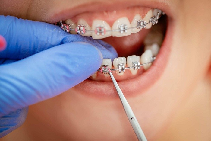 Top 10 nha khoa niềng răng uy tín tại TPHCM