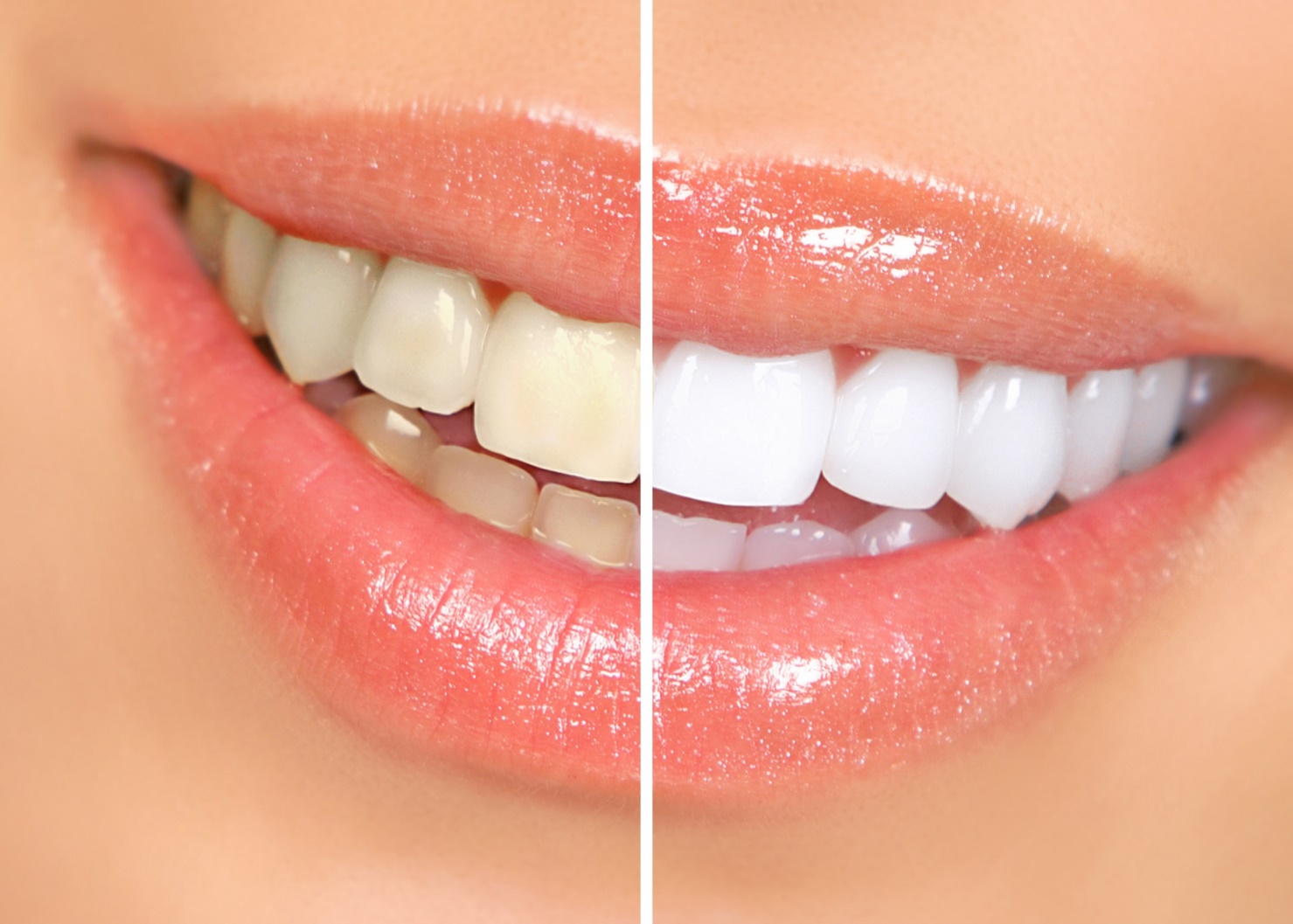 Top 10 nha khoa tẩy trắng răng uy tín tại TPHCM