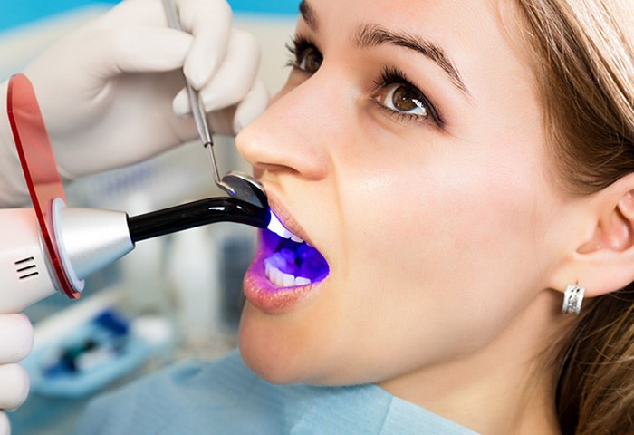 Top 10 nha khoa trám răng tốt nhất tại TPHCM